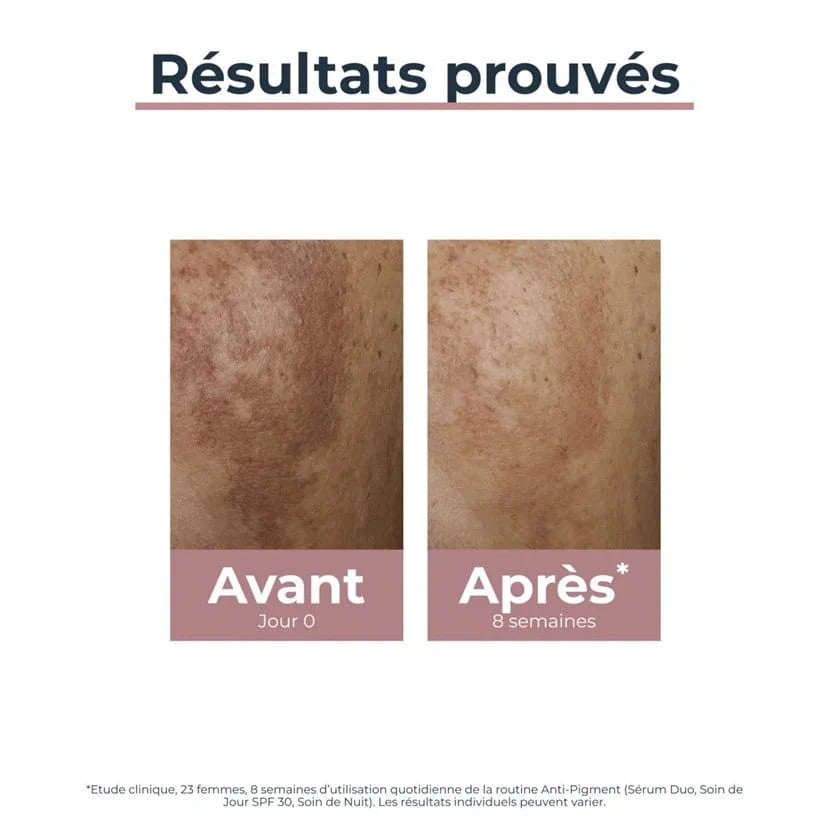 ANTI-PIGMENT Sérum Duo -EUCERIN